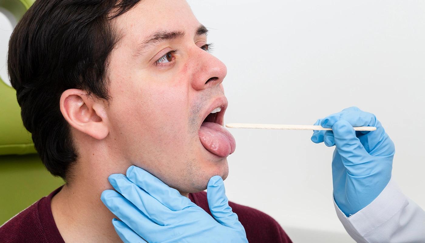 Doctor examining patient’s open mouth using wooden tongue depressor stick.